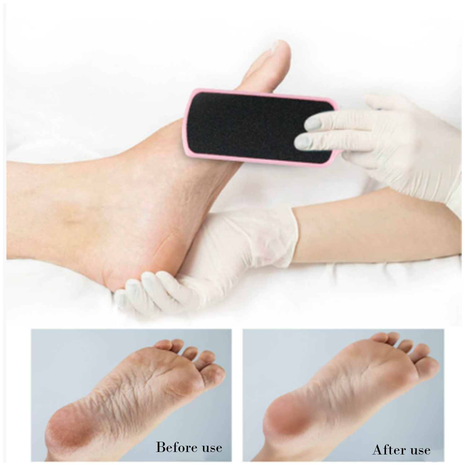 Disposable Foot File for Dead Skin and Callus Removal 3